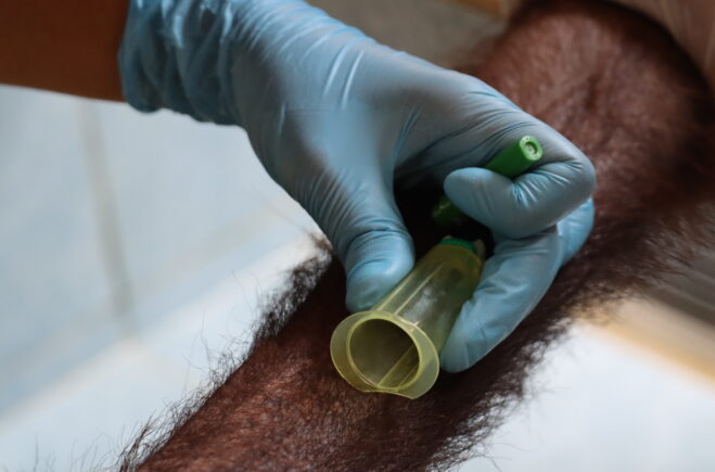 Orangutan arm outstretched so that blood can be taken from it by the vet for testing.